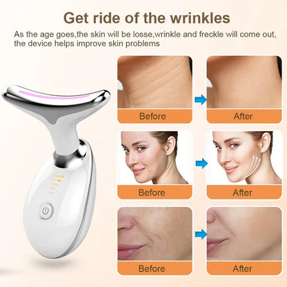 MasFace™ Masajeador Facial 3 en 1  ✨ - [PROMOCIÓN DISPONIBLE SOLO HOY]