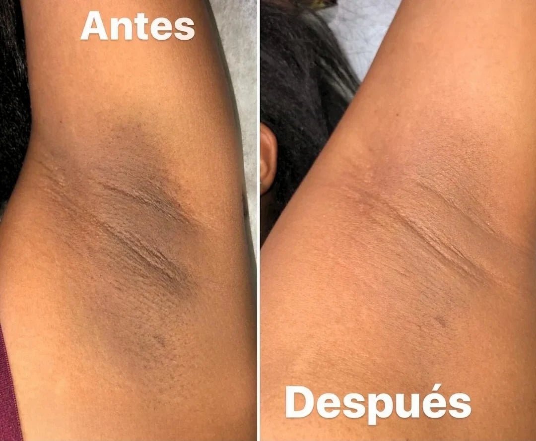 Dr Melaxin: Tratamiento despigmentante a base de Cúrcuma en Spray